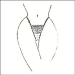 Ravage Autrefois  Thong